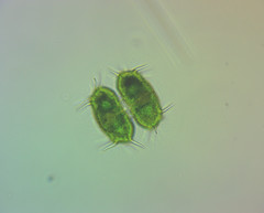 Xanthidium antilopaeum polymazum