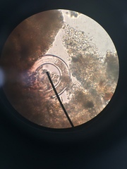 Spirostomum