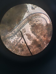 Spirostomum