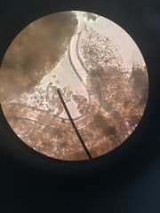 Spirostomum