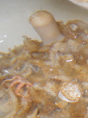 Tentorium semisuberites