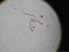 Ophiotheca chrysosperma