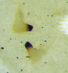 Maccevethus corsicus