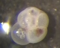 Globorotalia