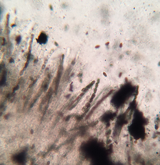 Annulohypoxylon annulatum