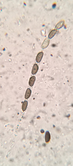 Annulohypoxylon annulatum