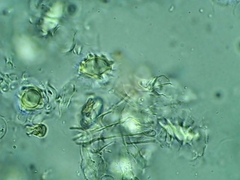 Chondrogaster pachysporus