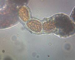 Trentepohlia umbrina