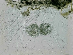 Vorticella campanula