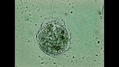 Vorticella campanula