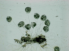 Vorticella campanula