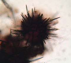 Acanthostigma multiseptatum