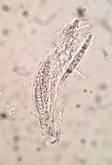 Acanthostigma multiseptatum