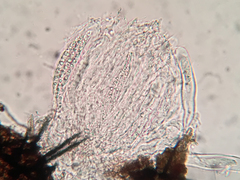 Acanthostigma multiseptatum