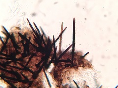 Acanthostigma multiseptatum