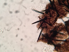 Acanthostigma multiseptatum