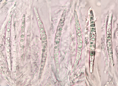 Acanthostigma multiseptatum