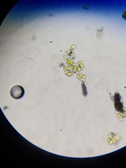 Desmococcus