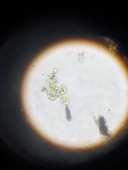 Desmococcus