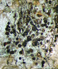 Bacidia leucothalamia