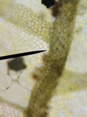 Geocalycaceae