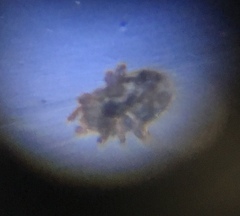 Ornithonyssus sylviarum