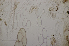 Pseudombrophila hepatica