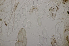 Pseudombrophila hepatica