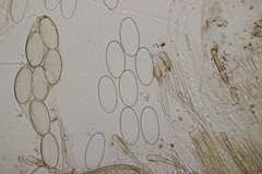 Pseudombrophila hepatica