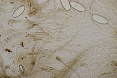 Pseudombrophila hepatica