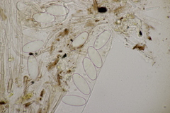 Pseudombrophila hepatica
