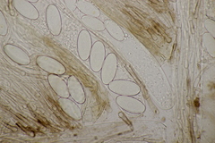 Pseudombrophila hepatica