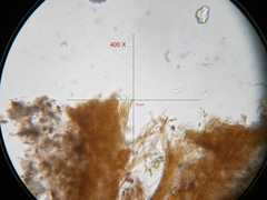 Mycetozoa