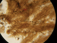 Mycetozoa