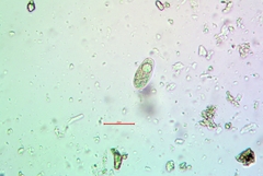 Aspicilia knudsenii