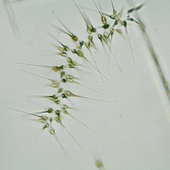 Asterionellopsis glacialis