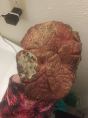 Fungi