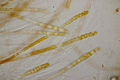 Lamprospora hispanica