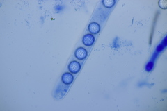 Lamprospora hispanica