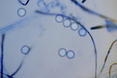 Lamprospora hispanica