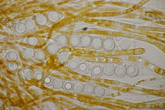 Lamprospora hispanica