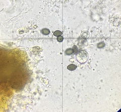 Podospora araneosa