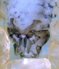 Peripsocus milleri