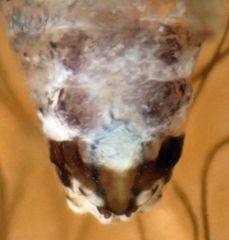 Mesopsocus immunis