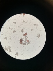 Fuligo septica candida
