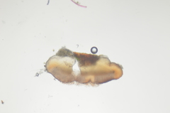Bacidia idahoensis
