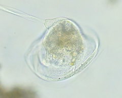 Vorticella campanula