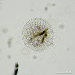 Actinosphaerium eichhornii