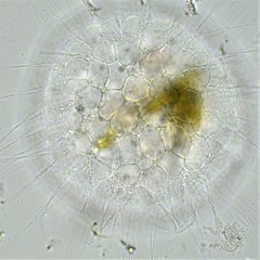 Actinosphaerium eichhornii