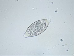 Trichuris